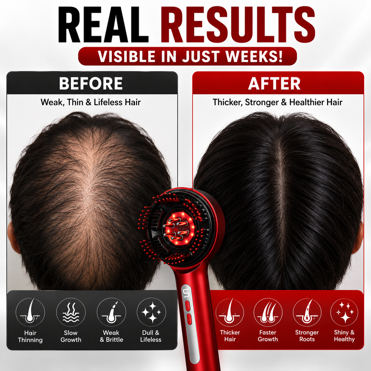 Advanced Red Light Hair Growth Comb™ | LED Scalp Massager for Thicker, Stronger & Healthier Hair | Rechargeable Hair Regrowth Brush